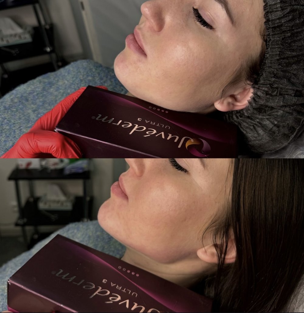 Contouring